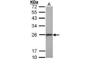 WB Image Sample (30 ug of whole cell lysate) A: Hep G2 , 12% SDS PAGE antibody diluted at 1:1000 (Transgelin Antikörper)