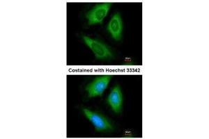 ICC/IF Image Immunofluorescence analysis of paraformaldehyde-fixed HeLa, using HPRT, antibody at 1:200 dilution. (HPRT1 Antikörper)