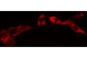 ABIN6274076 staining HeLa cells by IF/ICC. (FADD Antikörper  (pSer194))