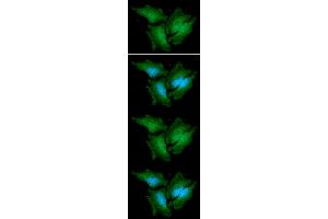 ICC/IF analysis of CTBP1 in A549 cells line, stained with DAPI (Blue) for nucleus staining and monoclonal anti-human CTBP1 antibody (1:100) with goat anti-mouse IgG-Alexa fluor 488 conjugate (Green) ICC/IF analysis of CTBP1 in HeLa cells line, stained with DAPI (Blue) for nucleus staining and monoclonal anti-human CTBP1 antibody (1:100) with goat anti-mouse IgG-Alexa fluor 488 conjugate (Green). (CTBP1 Antikörper  (AA 1-440))