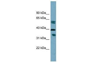 DHRS7B antibody used at 1 ug/ml to detect target protein. (DHRS7B Antikörper)