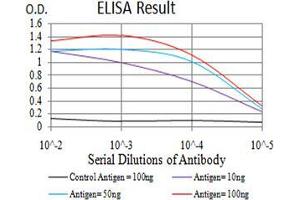 Fig. (TTF1 Antikörper  (AA 1-150))