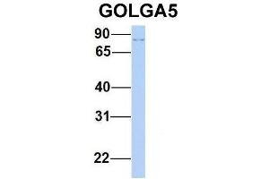 Host:  Rabbit  Target Name:  GOLGA5  Sample Type:  Human 293T  Antibody Dilution:  1. (GOLGA5 Antikörper  (N-Term))