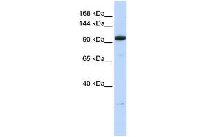 WB Suggested Anti-ZNF228 Antibody Titration:  0. (ZFP112 Antikörper  (N-Term))