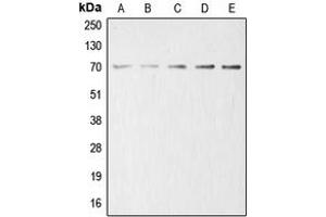 Western blot analysis of Acetylcholinesterase expression in HeLa (A), HEK293T (B), mouse liver (C), rat kidney (D), PC12 (E) whole cell lysates. (Acetylcholinesterase Antikörper  (Center))
