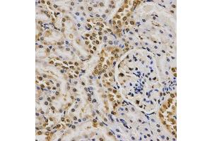 Immunohistochemistry (IHC) image for anti-Histone H4 (2meArg3) antibody (ABIN1872990)