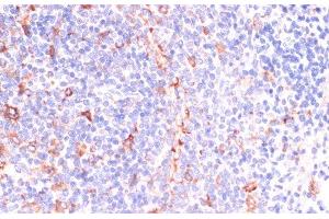 Immunohistochemistry of paraffin-embedded Rat spleen using IKBKE Polyclonal Antibody at dilution of 1:200 (40x lens). (IKKi/IKKe Antikörper)