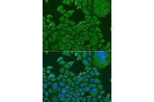 Immunofluorescence analysis of U2OS cells using FXR1 antibody. (FXR1 Antikörper  (AA 250-350))