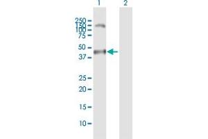 Western Blot analysis of MAGEA11 expression in transfected 293T cell line by MAGEA11 MaxPab polyclonal antibody. (MAGEA11 Antikörper  (AA 1-319))