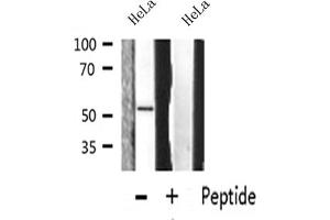 Western blot analysis on HeLa cell lysate using MMP-13 Antibody (MMP13 Antikörper  (N-Term))