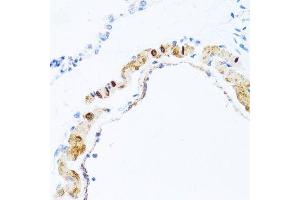 Immunohistochemistry of paraffin-embedded rat lung using PHPT1 antibody. (PHPT1 Antikörper  (AA 1-125))