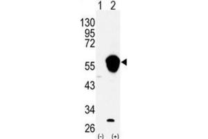 Western Blotting (WB) image for anti-Aldehyde Dehydrogenase 3 Family, Member A1 (ALDH3A1) antibody (ABIN3003526) (ALDH3A1 Antikörper)