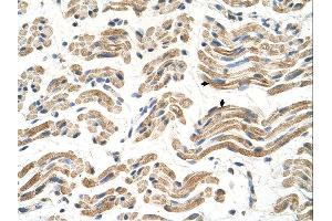 Immunohistochemistry (IHC) image for anti-Aldehyde Dehydrogenase 4 Family, Member A1 (ALDH4A1) (C-Term) antibody (ABIN2782324) (ALDH4A1 Antikörper  (C-Term))