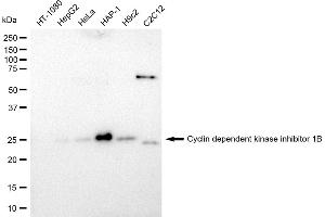 Western blotting analysis using Cyclin dependent kinase inhibitor 1B antibody (ABIN7798223). (Rekombinanter CDKN1B Antikörper)