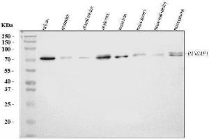 Western blot analysis of RANGAP1 using anti-RANGAP1 antibody (ABIN7600225).