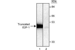 Western Blotting (WB) image for anti-E2F Transcription Factor 1 (E2F1) antibody (ABIN967439) (E2F1 Antikörper)