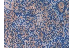 IHC-P analysis of Mouse Ovary Tissue, with DAB staining. (PON2 Antikörper  (AA 4-289))
