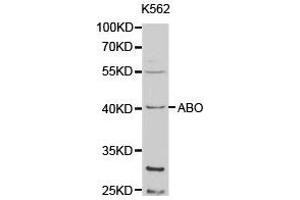 Western Blotting (WB) image for anti-Histo-blood group A transferase (ABO) antibody (ABIN1870743) (ABO Antikörper)