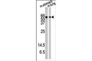 Image no. 1 for anti-V-Akt Murine Thymoma Viral Oncogene Homolog 1 (AKT1) (pTyr326) antibody (ABIN358076) (AKT1 Antikörper  (pTyr326))