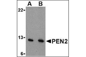 Western blot analysis of PEN2 in A-20 cell lysate with this product at (A) 0. (PEN2 Antikörper  (N-Term))
