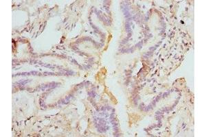 Immunohistochemistry of paraffin-embedded human lung tissue using ABIN7152931 at dilution of 1:100 (FCN1 Antikörper  (AA 30-326))