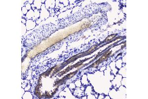 Immunohistochemistry (IHC) image for anti-Betacellulin (BTC) (AA 32-177) antibody (ABIN5692803)