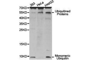 Western Blotting (WB) image for anti-Ubiquitin B (UBB) antibody (ABIN1875247) (Ubiquitin B Antikörper)