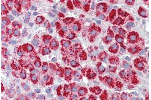 Human Adrenal (formalin-fixed, paraffin-embedded) stained with HSPD1 antibody ABIN462365 followed by biotinylated anti-goat IgG secondary antibody ABIN481715, alkaline phosphatase-streptavidin and chromogen. (HSPD1 Antikörper)