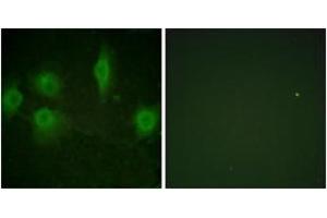 Immunofluorescence analysis of HuvEc cells, using IL-9R (Phospho-Ser519) Antibody. (IL9 Receptor Antikörper  (pSer519))