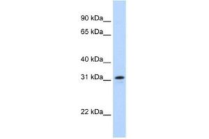 WB Suggested Anti-MKI67IP Antibody Titration:  0. (NIFK Antikörper  (Middle Region))