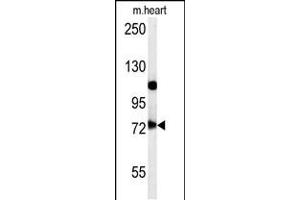 Western blot analysis in mouse heart tissue lysates (15ug/lane). (USP49 Antikörper  (N-Term))