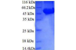SDS-PAGE (SDS) image for Ribosomal Protein S6 Kinase, 70kDa, Polypeptide 2 (RPS6KB2) (AA 1-210), (partial) protein (GST tag) (ABIN7479316)
