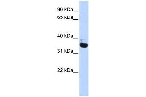 Western Blotting (WB) image for anti-Olfactory Receptor, Family 13, Subfamily C, Member 5 (OR13C5) (N-Term) antibody (ABIN927358)
