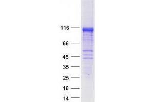 Western Blotting (WB) image for Ras and Rab Interactor 2 (RIN2) protein (Myc-DYKDDDDK Tag) (ABIN2730929)