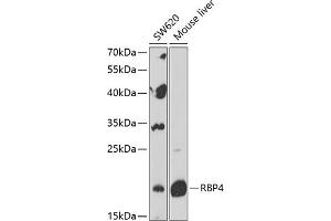 Western blot analysis of extracts of various cell lines, using RBP4 Antibody (ABIN6128555, ABIN6146803, ABIN6146804 and ABIN6216143) at 1:1000 dilution. (RBP4 Antikörper  (AA 19-201))
