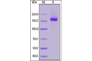 SDS-PAGE (SDS) image for Mannose Receptor, C Type 1 (MRC1) (AA 19-1389) protein (His tag) (ABIN6952276)