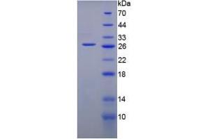 SDS-PAGE analysis of Mouse Gremlin 1 Protein. (GREM1 Protein)