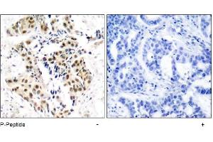 Image no. 1 for anti-Ataxia Telangiectasia Mutated (ATM) (pSer1981) antibody (ABIN196823) (ATM Antikörper  (pSer1981))