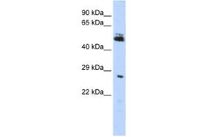 Western Blotting (WB) image for anti-Ring Finger Protein 212 (RNF212) antibody (ABIN2458754) (RNF212 Antikörper)