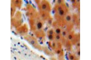 Used in DAB staining on fromalin fixed paraffin-embedded Liver tissue (C4BPA Antikörper  (AA 548-597))