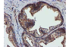 Image no. 10 for anti-Epsin 2 (EPN2) antibody (ABIN1498051) (Epsin 2 Antikörper)