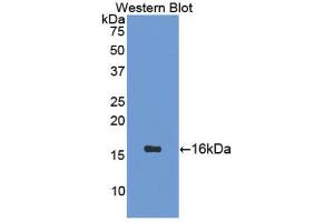 Western blot analysis of the recombinant protein. (Secretin Antikörper  (AA 26-133))