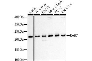 Western blot analysis of extracts of various cell lines, using R antibody (ABIN6133888, ABIN6146605, ABIN6146608 and ABIN6216535) at 1:1000 dilution. (RAB7A Antikörper  (C-Term))