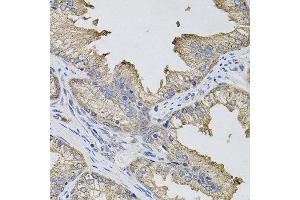 Immunohistochemistry of paraffin-embedded human prostate using IFNG antibody. (Interferon gamma Antikörper)