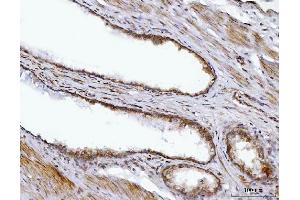 IHC analysis of BBS9 using anti-BBS9 antibody (ABIN7601518). (BBS9 Antikörper  (AA 37-793))