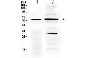 Western blot analysis of TNFRSF1A using anti- TNFRSF1A antibody .