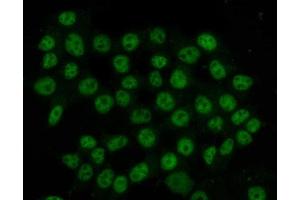 IF analysis of HnRNP H/HNRNPH1 using anti-HnRNP H/HNRNPH1 antibody (ABIN4886623).