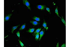 Immunofluorescence (IF) image for anti-Phosphoinositide 3-kinase Regulatory Subunit 4 (PIK3R4) (AA 1300-1358), (Regulatory Subunit 4) antibody (ABIN7163291)