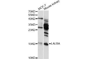 Western blot analysis of extracts of various cell lines, using LALBA antibody (ABIN6292168) at 1:3000 dilution. (LALBA Antikörper)