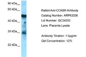 Western Blotting (WB) image for anti-Cholecystokinin B Receptor (CCKBR) (C-Term) antibody (ABIN2789413) (CCKBR Antikörper  (C-Term))